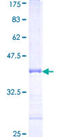 RPL34 / Ribosomal Protein L34 Protein - 12.5% SDS-PAGE Stained with Coomassie Blue.