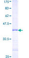 RPL34 / Ribosomal Protein L34 Protein - 12.5% SDS-PAGE Stained with Coomassie Blue.