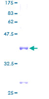 RPL35 / Ribosomal Protein L35 Protein - 12.5% SDS-PAGE of human RPL35 stained with Coomassie Blue