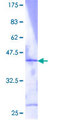 RPL36 / Ribosomal Protein L36 Protein - 12.5% SDS-PAGE of human RPL36 stained with Coomassie Blue