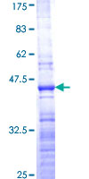 RPL36 / Ribosomal Protein L36 Protein - 12.5% SDS-PAGE of human RPL36 stained with Coomassie Blue