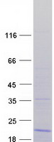 RPL36 / Ribosomal Protein L36 Protein - Purified recombinant protein RPL36 was analyzed by SDS-PAGE gel and Coomassie Blue Staining