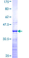 RPL36A / Ribosomal Protein L36 Protein - 12.5% SDS-PAGE Stained with Coomassie Blue.