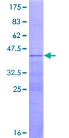 RPL36AL Protein - 12.5% SDS-PAGE of human RPL36AL stained with Coomassie Blue