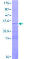 RPL36AL Protein - 12.5% SDS-PAGE of human RPL36AL stained with Coomassie Blue