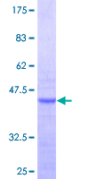 RPL36AL Protein - 12.5% SDS-PAGE Stained with Coomassie Blue.