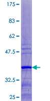 RPL37 / Ribosomal Protein L37 Protein - 12.5% SDS-PAGE of human RPL37 stained with Coomassie Blue