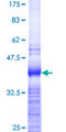 RPL37 / Ribosomal Protein L37 Protein - 12.5% SDS-PAGE Stained with Coomassie Blue.