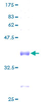RPL37A Protein - 12.5% SDS-PAGE of human RPL37A stained with Coomassie Blue