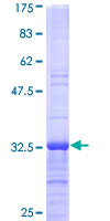RPL37A Protein - 12.5% SDS-PAGE Stained with Coomassie Blue.