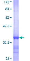 RPL38 / Ribosomal Protein L38 Protein - 12.5% SDS-PAGE Stained with Coomassie Blue.