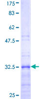 RPL39 / Ribosomal Protein L39 Protein - 12.5% SDS-PAGE Stained with Coomassie Blue.