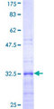 RPL39 / Ribosomal Protein L39 Protein - 12.5% SDS-PAGE Stained with Coomassie Blue.