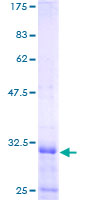 RPL39L Protein - 12.5% SDS-PAGE of human RPL39L stained with Coomassie Blue