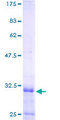 RPL39L Protein - 12.5% SDS-PAGE of human RPL39L stained with Coomassie Blue