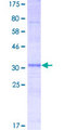 RPL3L Protein - 12.5% SDS-PAGE Stained with Coomassie Blue.