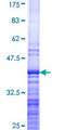 RPL4 / Ribosomal Protein L4 Protein - 12.5% SDS-PAGE Stained with Coomassie Blue.