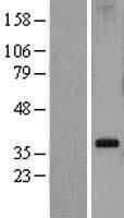 RPL5 / Ribosomal Protein L5 Protein - Western validation with an anti-DDK antibody * L: Control HEK293 lysate R: Over-expression lysate