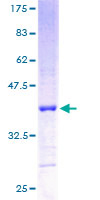 RPL5 / Ribosomal Protein L5 Protein - 12.5% SDS-PAGE of human RPL5 stained with Coomassie Blue