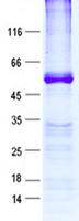 RPL5 / Ribosomal Protein L5 Protein