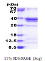 RPL5 / Ribosomal Protein L5 Protein