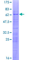 RPL6 / Ribosomal Protein L6 Protein - 12.5% SDS-PAGE of human RPL6 stained with Coomassie Blue