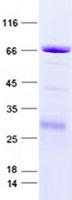 RPL6 / Ribosomal Protein L6 Protein