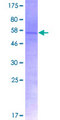 RPL7 / Ribosomal Protein L7 Protein - 12.5% SDS-PAGE of human RPL7 stained with Coomassie Blue