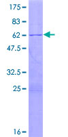RPL7A / Ribosomal Protein L7a Protein - 12.5% SDS-PAGE of human RPL7A stained with Coomassie Blue