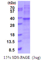 RPL7A / Ribosomal Protein L7a Protein