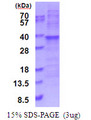 RPL7A / Ribosomal Protein L7a Protein