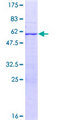RPL7L1 Protein - 12.5% SDS-PAGE of human RPL7L1 stained with Coomassie Blue