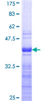 RPL8 / Ribosomal Protein L8 Protein - 12.5% SDS-PAGE Stained with Coomassie Blue.
