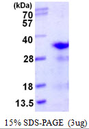 RPL8 / Ribosomal Protein L8 Protein