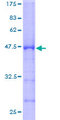 RPL9 / Ribosomal Protein L9 Protein - 12.5% SDS-PAGE of human RPL9 stained with Coomassie Blue