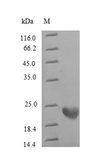 RPL9 / Ribosomal Protein L9 Protein - (Tris-Glycine gel) Discontinuous SDS-PAGE (reduced) with 5% enrichment gel and 15% separation gel.