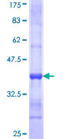 RPL9 / Ribosomal Protein L9 Protein - 12.5% SDS-PAGE Stained with Coomassie Blue.