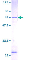 RPLP0 Protein - 12.5% SDS-PAGE of human RPLP0 stained with Coomassie Blue