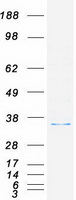 RPLP0 Protein - Purified recombinant protein RPLP0 was analyzed by SDS-PAGE gel and Coomassie Blue Staining