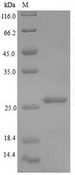 RPLP1 Protein - (Tris-Glycine gel) Discontinuous SDS-PAGE (reduced) with 5% enrichment gel and 15% separation gel.