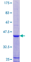 RPLP1 Protein - 12.5% SDS-PAGE of human RPLP1 stained with Coomassie Blue