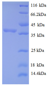 RPLP2 Protein