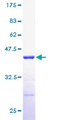 RPLP2 Protein - 12.5% SDS-PAGE of human RPLP2 stained with Coomassie Blue