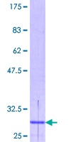RPLP2 Protein - 12.5% SDS-PAGE Stained with Coomassie Blue.