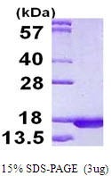 RPLP2 Protein