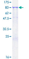 RPN1 / Ribophorin I Protein - 12.5% SDS-PAGE of human RPN1 stained with Coomassie Blue