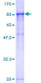 RPN1 / Ribophorin I Protein - 12.5% SDS-PAGE of human RPN1 stained with Coomassie Blue