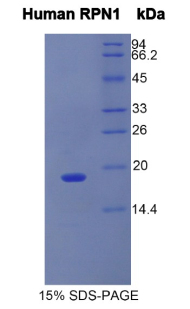 RPN1 / Ribophorin I Protein - Recombinant Ribophorin I By SDS-PAGE