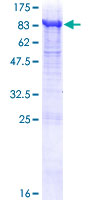 RPN2 / Ribophorin II Protein - 12.5% SDS-PAGE of human RPN2 stained with Coomassie Blue