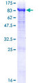 RPN2 / Ribophorin II Protein - 12.5% SDS-PAGE of human RPN2 stained with Coomassie Blue